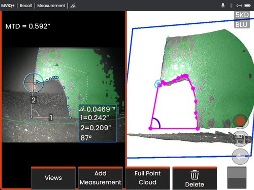 MViQ+ features readily available Learn More content as well as high-resolution imaging with Real3D™ Measurement, including automated measurements like Missing Corner.