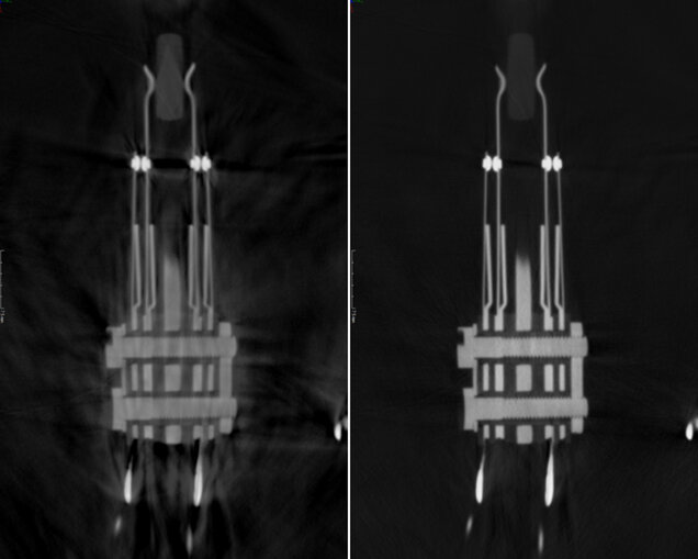 Scatter|correct X-rays