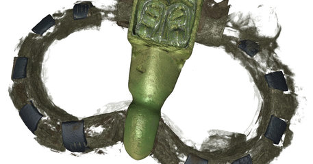 ct image buckle