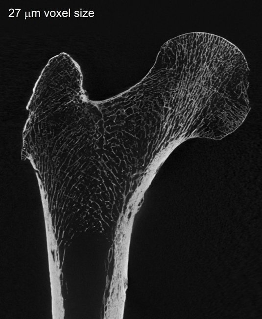 WT CT scan of human femur.jpg