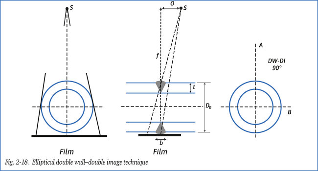 Elliptical double wall-double image technique