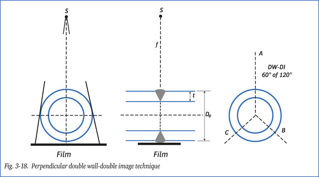 Perpendicular double wall-double image technique