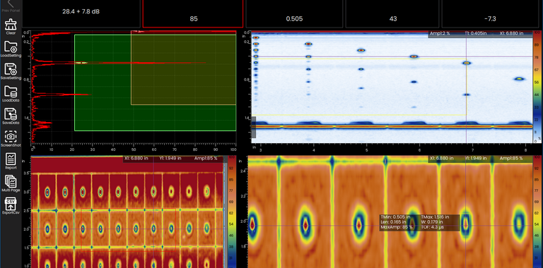 Ultrasonic Scan